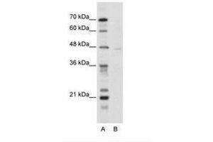 Image no. 1 for anti-Tripartite Motif Containing 38 (TRIM38) (N-Term) antibody (ABIN202589) (TRIM38 anticorps  (N-Term))
