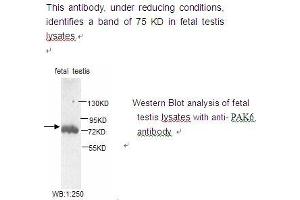 Image no. 1 for anti-P21-Activated Kinase 6 (PAK6) antibody (ABIN790802) (PAK6 anticorps)