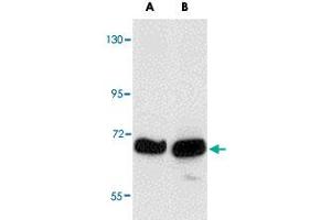 Western blot analysis of KLHL15 in HeLa cell lysate with KLHL15 polyclonal antibody  at (A) 1 and (B) 2 ug/mL . (KLHL15 anticorps  (C-Term))