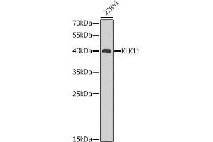Western blot analysis of extracts of 22Rv1 cells, using KLK11 antibody (ABIN6129403, ABIN6142946, ABIN6142948 and ABIN6216242) at 1:1000 dilution. (Kallikrein 11 anticorps  (AA 1-250))