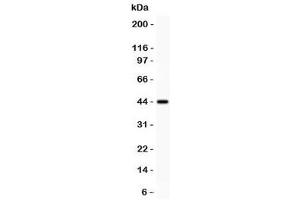 Western blot testing of Mesothelin antibody and recombinant human protein (0. (Mesothelin anticorps  (AA 306-576))