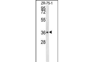 NIT1 Antibody (C-term) (ABIN656966 and ABIN2846150) western blot analysis in ZR-75-1 cell line lysates (35 μg/lane). (Nitrilase 1 anticorps  (C-Term))
