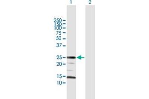 Western Blot analysis of ARHGDIA expression in transfected 293T cell line by ARHGDIA MaxPab polyclonal antibody.