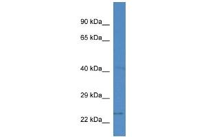 WB Suggested Anti-Slc10a2 Antibody   Titration: 1. (SLC10A2 anticorps  (N-Term))