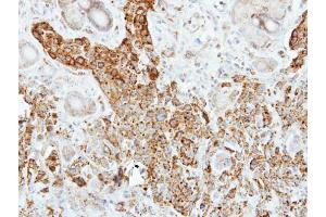 IHC-P Image Immunohistochemical analysis of paraffin-embedded SCM-1 xenograft, using Pancreatic Lipase, antibody at 1:500 dilution.