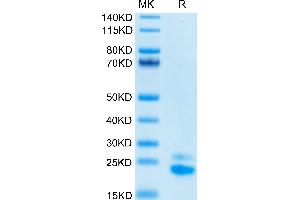 Biotinylated Human TRAIL R2 on Tris-Bis PAGE under reduced conditions. (TNFRSF10B Protein (His-Avi Tag,Biotin))