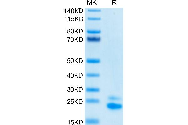TNFRSF10B Protein (His-Avi Tag,Biotin)