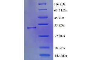 SDS-PAGE (SDS) image for ATP Synthase Mitochondrial F1 Complex Assembly Factor 2 (ATPAF2) (AA 41-289) protein (His tag) (ABIN5709111)