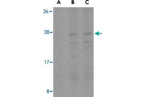Western blot analysis of BID in A-549 cell lysates with BID polyclonal antibody  at (A) 0. (BID anticorps  (Internal Region))