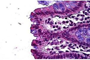Human Colon, Epithelium: Formalin-Fixed, Paraffin-Embedded (FFPE) (LEO1 anticorps  (AA 550-600))