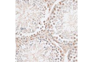 Immunohistochemistry of paraffin-embedded mouse testis using HMGN1 antibody.