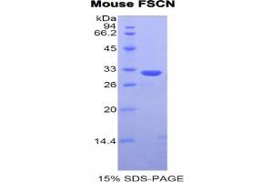 SDS-PAGE analysis of Mouse Fascin Protein. (Fascin Protein (FSCN1))