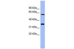 Image no. 1 for anti-Headcase Homolog (HECA) (AA 359-408) antibody (ABIN6744096) (HECA anticorps  (AA 359-408))