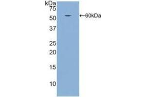 Detection of Recombinant ITGb1, Human using Polyclonal Antibody to Integrin Beta 1 (ITGb1) (ITGB1 anticorps  (AA 140-383))