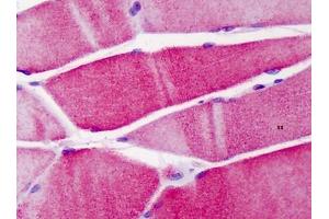 Human Skeletal Muscle: Formalin-Fixed, Paraffin-Embedded (FFPE)