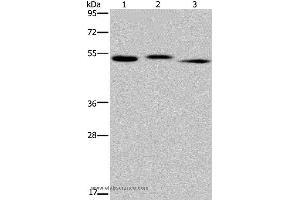 Western blot analysis of Human kidney tissue, HepG2 cell and human testis tissue, using HYAL3 Polyclonal Antibody at dilution of 1:400 (HYAL3 anticorps)