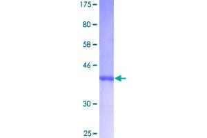 Image no. 1 for Cyclin-Dependent Kinase Inhibitor 2B (p15, Inhibits CDK4) (CDKN2B) (AA 1-138) protein (GST tag) (ABIN1349020)