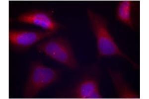 Image no. 3 for anti-Eukaryotic Translation Initiation Factor 2-alpha Kinase 2 (EIF2AK2) (pThr446) antibody (ABIN197048) (EIF2AK2 anticorps  (pThr446))