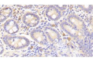 Detection of STAT1 in Human Small intestine Tissue using Polyclonal Antibody to Signal Transducer And Activator Of Transcription 1 (STAT1)