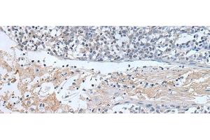 Immunohistochemistry of paraffin-embedded Human tonsil tissue using ABR Polyclonal Antibody at dilution of 1:50(x200) (ABR anticorps)
