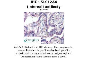Image no. 1 for anti-Solute Carrier Family 12 (Potassium-Chloride Transporter) Member 4 (SLC12A4) (Internal Region) antibody (ABIN1739330) (SLC12A4 anticorps  (Internal Region))