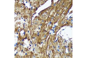 Immunohistochemistry of paraffin-embedded Mouse heart using [KO Validated] NSDHL Rabbit pAb (ABIN7268794) at dilution of 1:100 (40x lens). (NSDHL anticorps  (AA 1-240))