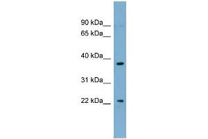 WB Suggested Anti-FOXN4 Antibody Titration:  0.