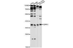 Western blot analysis of extracts of various cell lines, using ADPRH antibody (ABIN1980293) at 1:1000 dilution.