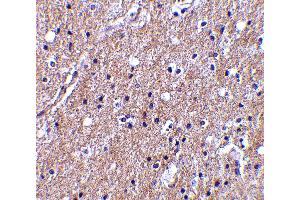 Immunohistochemistry (IHC) image for anti-Complement C1q Tumor Necrosis Factor-Related Protein 6 (C1QTNF6) (Middle Region) antibody (ABIN1030915) (CTRP6 anticorps  (Middle Region))