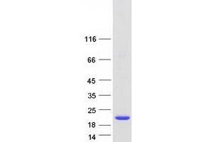 Protein CutA (CUTA) (Transcript Variant 4) protein (Myc-DYKDDDDK Tag)