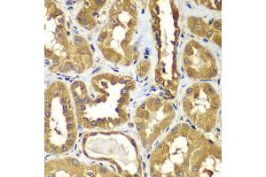 Immunohistochemistry of paraffin-embedded human kidney using RAB1B antibody at dilution of 1:100 (x400 lens). (RAB1B anticorps)