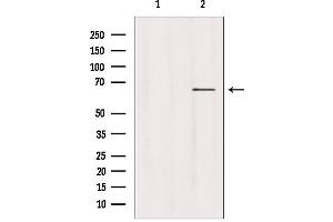 Western blot analysis of extracts from hepg2, using USP39 antibody. (USP39 anticorps  (N-Term))
