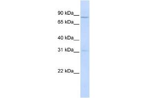 POMT1 antibody used at 1 ug/ml to detect target protein. (POMT1 anticorps  (Middle Region))