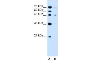ZFYVE27 antibody used at 2. (ZFYVE27 anticorps  (C-Term))