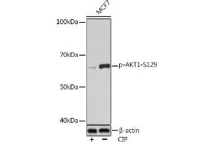 Western blot analysis of extracts of MCF7 cells, using Phospho--S129 Rabbit mAb (ABIN7271246) at 1:1000 dilution. (AKT1 anticorps  (pSer129))