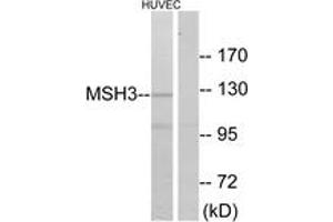Western blot analysis of extracts from HuvEc cells, using MSH3 Antibody. (MSH3 anticorps  (AA 51-100))