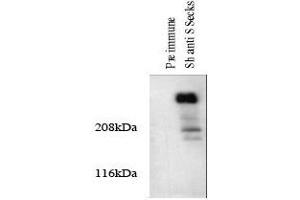 Western blotting total cellular protein from cultured rat aortic smooth muscle cells was prepared and analyze. (AKAP12 anticorps)