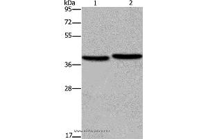 Western blot analysis of MCF-7 and NIH/3T3 cell, using FHL1 Polyclonal Antibody at dilution of 1:400 (FHL1 anticorps)