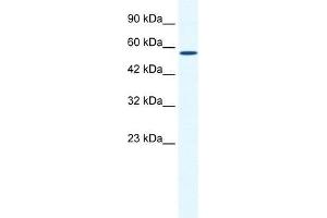 BTBD15 antibody used at 0. (ZBTB44 anticorps  (C-Term))