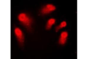 Immunofluorescent analysis of AIRE staining in Jurkat cells.