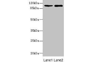 Western blot All lanes: GRIK3 antibody at 1. (GRIK3 anticorps  (AA 32-240))