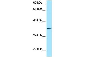 WB Suggested Anti-QKI AntibodyTitration: 1. (QKI anticorps  (N-Term))
