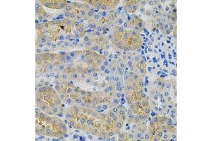 Immunohistochemistry of paraffin-embedded mouse kidney using ANGPTL3 Antibody (ABIN5970263) at dilution of 1/100 (40x lens). (ANGPTL3 anticorps)