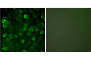 Immunofluorescence analysis of A549 cells, using E-cadherin Antibody.