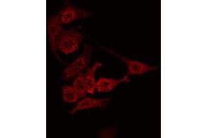 ABIN6274849 staining Hela by IF/ICC. (ANGPTL7 anticorps  (C-Term))