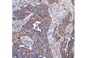 IHC analysis of EML4 using anti-EML4 antibody (ABIN6719384). (EML4 anticorps  (AA 207-423))