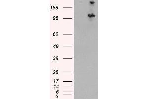 HEK293 overexpressing Human TSC1 and probed with ABIN2562994 (mock transfection in first lane). (TSC1 anticorps  (C-Term, Isoform 1))