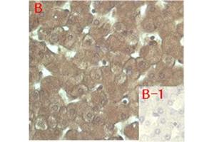 Immunohistochemical staining of human tissue using anti-FGF-23 (human), mAb (FG322-3)  at 1:200 dilution. (FGF23 anticorps)