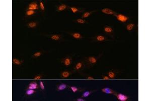 Immunofluorescence analysis of C6 cells using ALOX5 Polyclonal Antibody at dilution of 1:100. (ALOX5 anticorps)