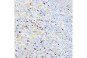 Immunohistochemistry of paraffin-embedded rat spleen using NEDD9 Rabbit pAb (ABIN3023330, ABIN3023331, ABIN3023332 and ABIN6219606) at dilution of 1:100 (40x lens).